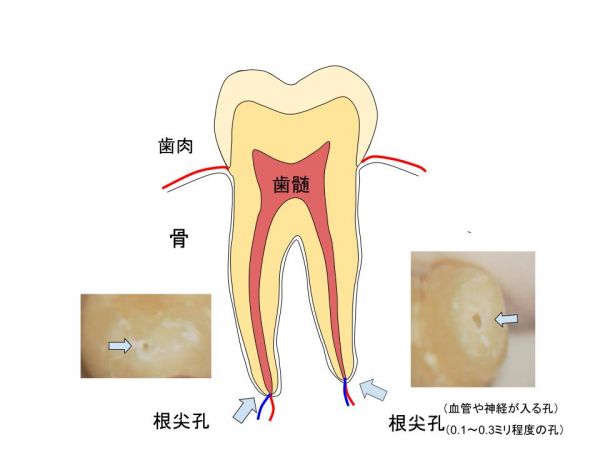 根管と根尖孔