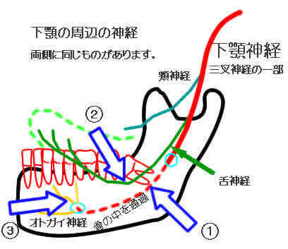 下顎の周辺の神経の走行を示した解剖図。下顎神経から枝分かれする下歯槽神経・舌神経・オトガイ神経の位置関係
