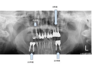 現在の口の中の状態